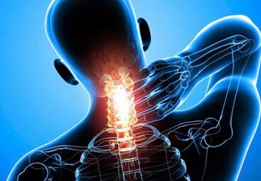 dor intensa no pescoço com osteocondrose avançada