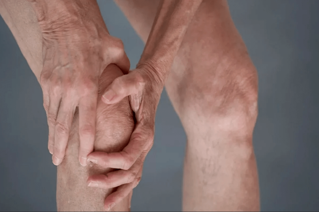 dor nas articulações pode ser a causa de artrose ou artrite