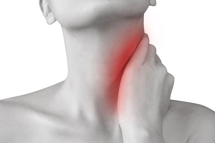 inflamação dos gânglios linfáticos como causa de dor no pescoço