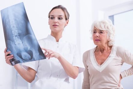O exame de raios-X é uma maneira informativa de diagnosticar a osteocondrose da coluna