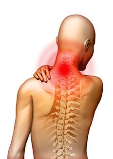 A dor é o principal sintoma da osteocondrose cervical