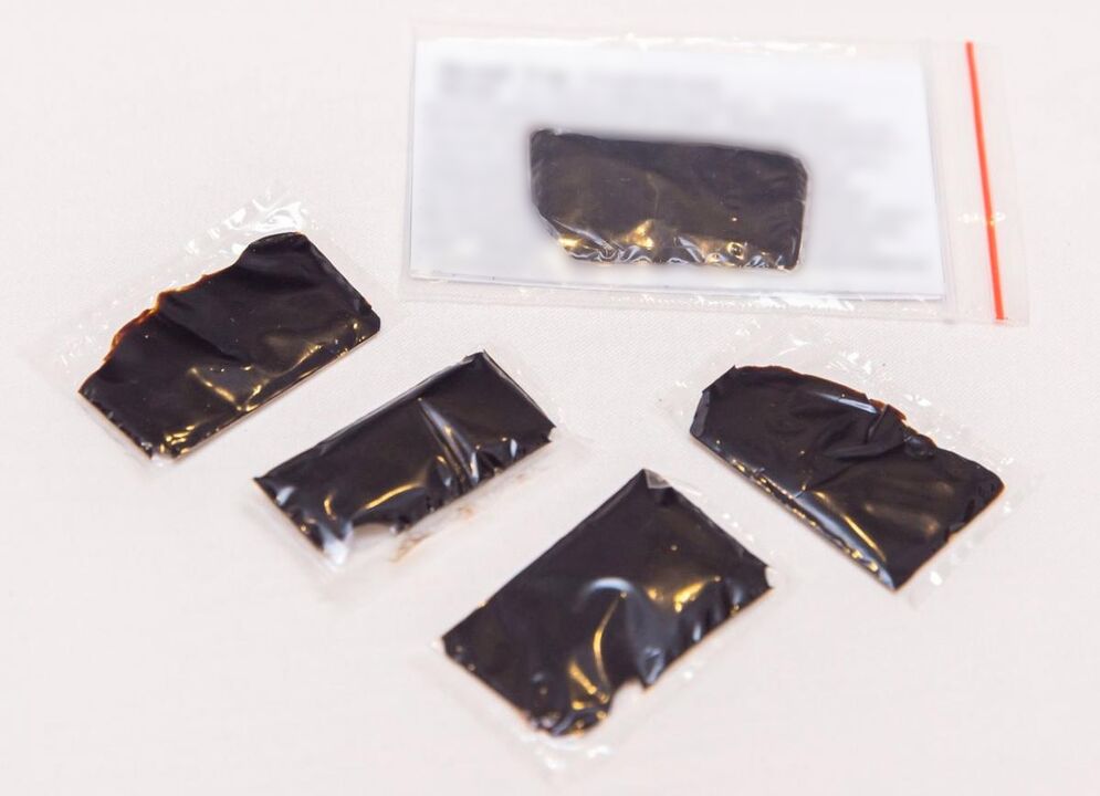 Shilajit é um remédio eficaz para o tratamento da osteocondrose cervical em casa