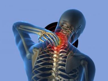 Uma pessoa com osteocondrose da coluna cervical é incomodada por dores no pescoço